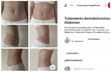 Resultado con 7 sesiones y varios aparatos