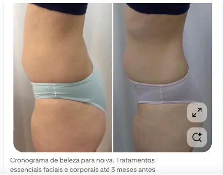 Resultado tras 3 meses de tratamientos sin sistema
